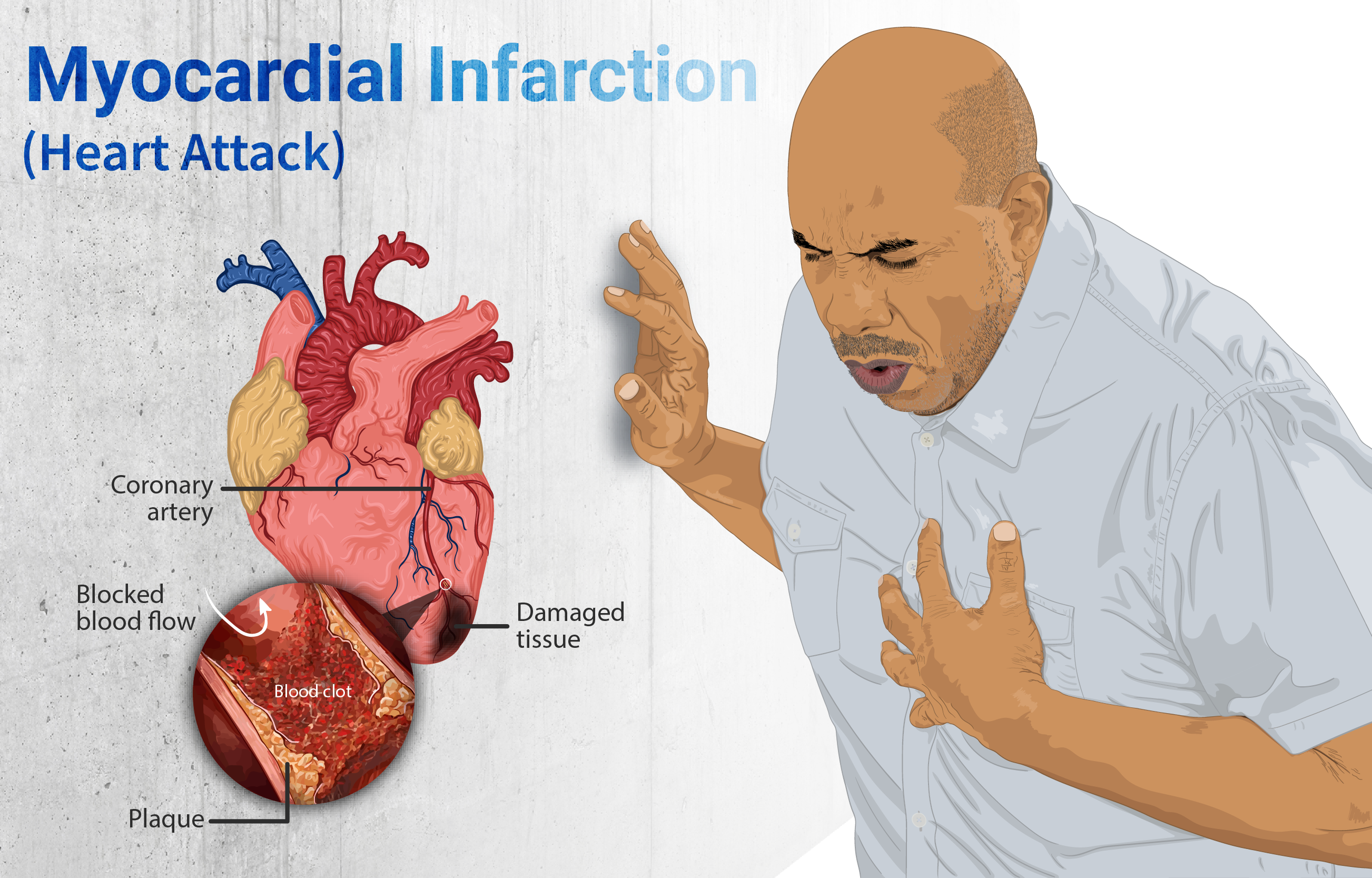 Emotional well-being And Heart Attacks: What You Need To Know
